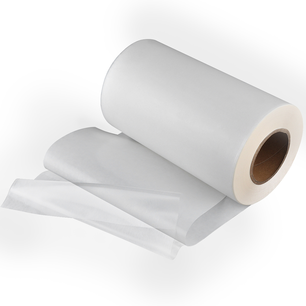 Global Thermoplastic Polyurethane Films (TPU) Market Insights, Forecast to 2026