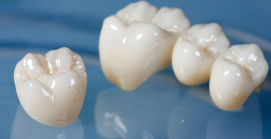 Global Zirconia Ceramic Market Research Report 2020