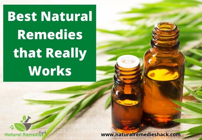 Best Natural Remedies that Really Works