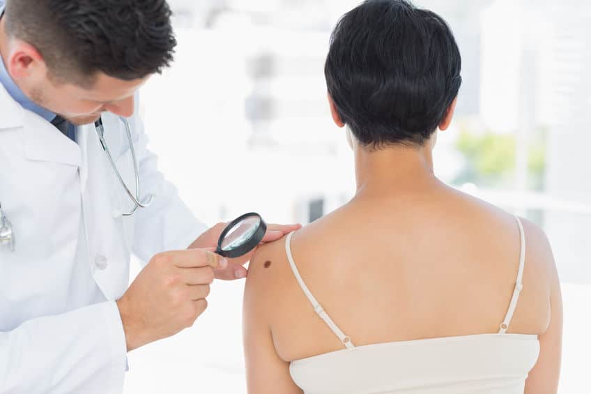 Skin Tag Removal