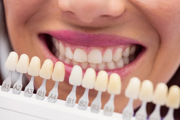 Best retainers teeth treatment service in Fort Washington
