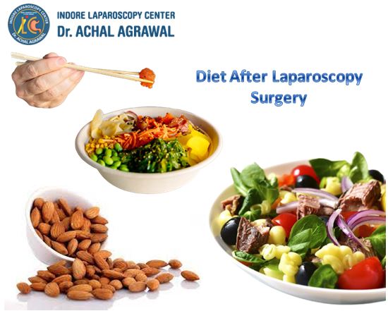 Diet After Laparoscopy Surgery - By Dr. Achal Agrawal