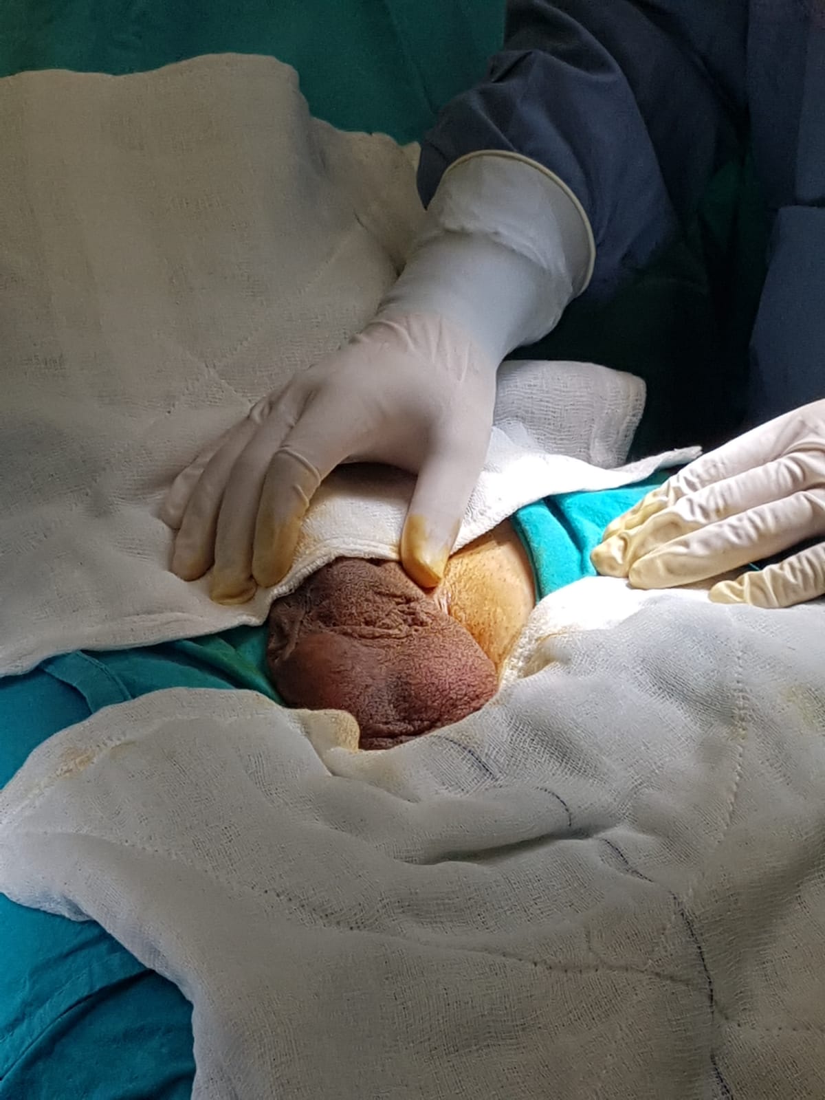 Istanbul en iyi üroloji doktoru