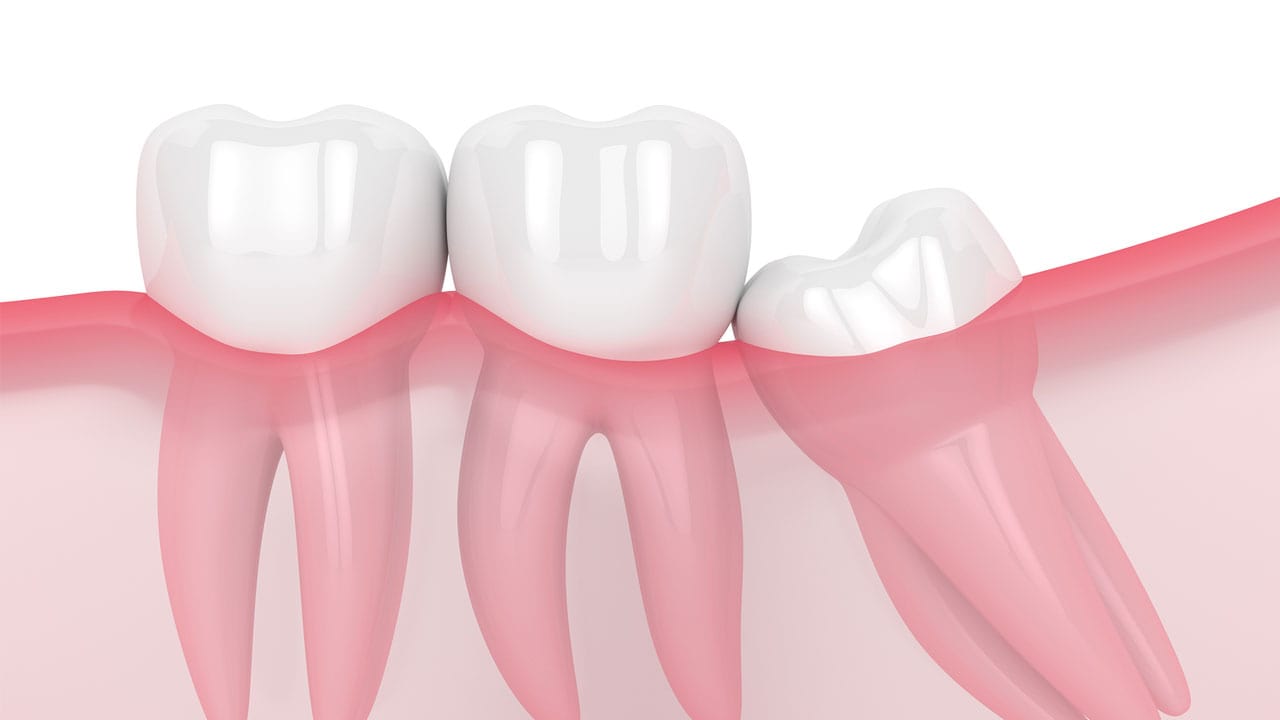 San Diego Dentist Is There To Mitigate All Your Dental Woes.