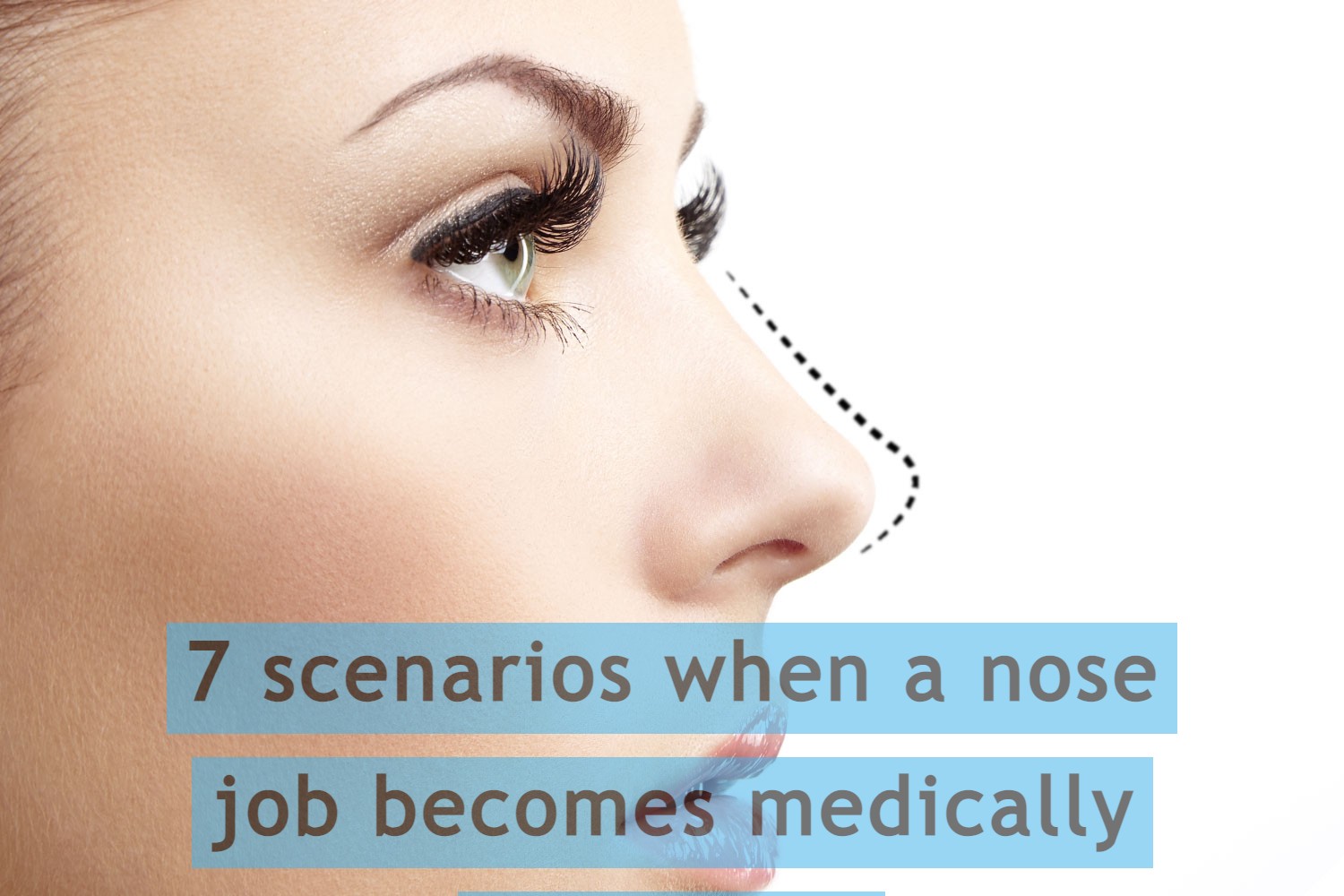 7 scenarios when a nose job becomes medically necessary