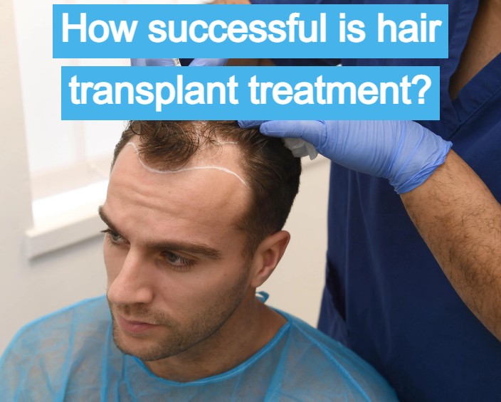 How successful is hair transplant treatment?