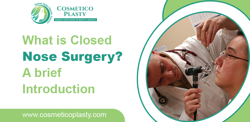 What is closed nose surgery? | A brief introduction