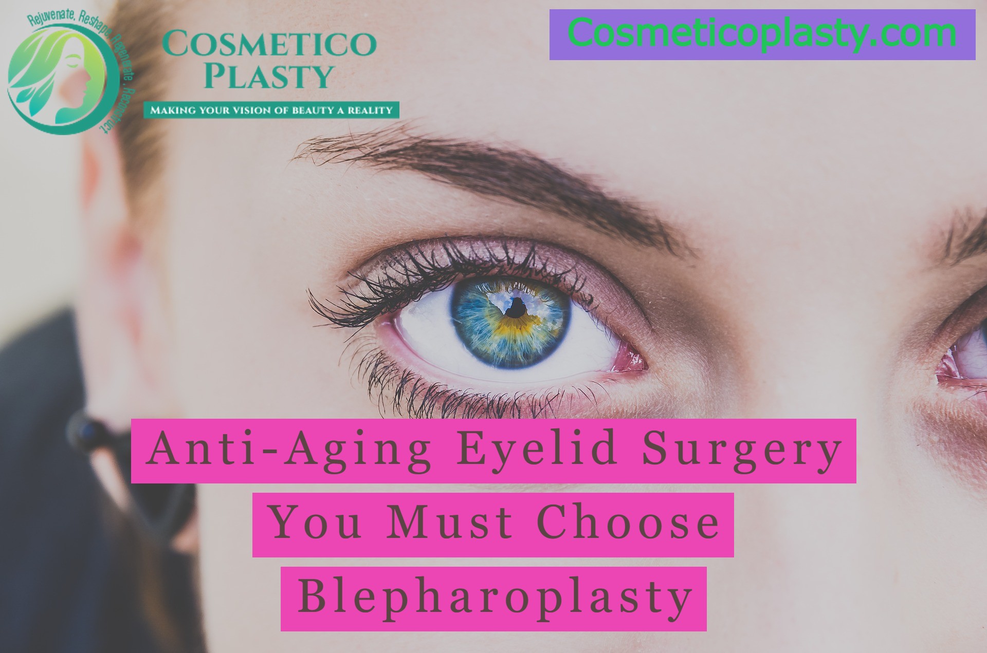 Anti-Aging Eyelid Surgery You Must Choose Blepharoplasty