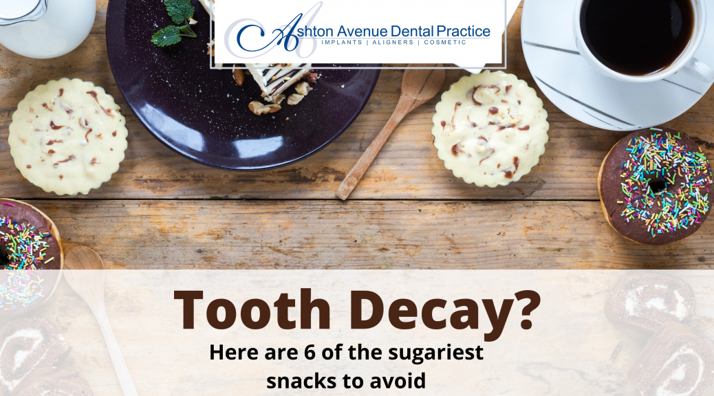 Tooth Decay Check: 6 Of The Sugariest Snacks To Avoid