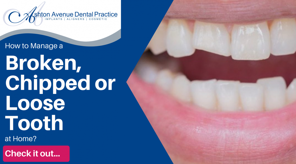 How to manage a broken, chipped or loose tooth at home?