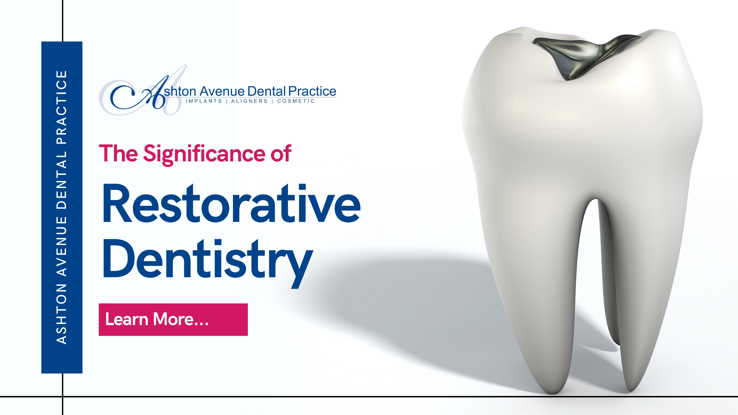 The Importance of Restorative Dentistry