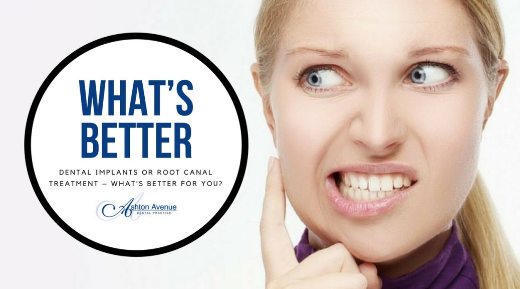 Dental implants or root canal treatment – what’s better for you?