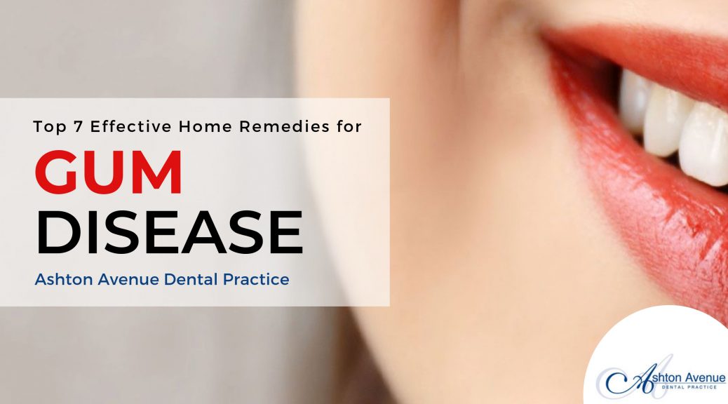 Gum Disease Treatment At Home: Top 7 Effective Home Remedies