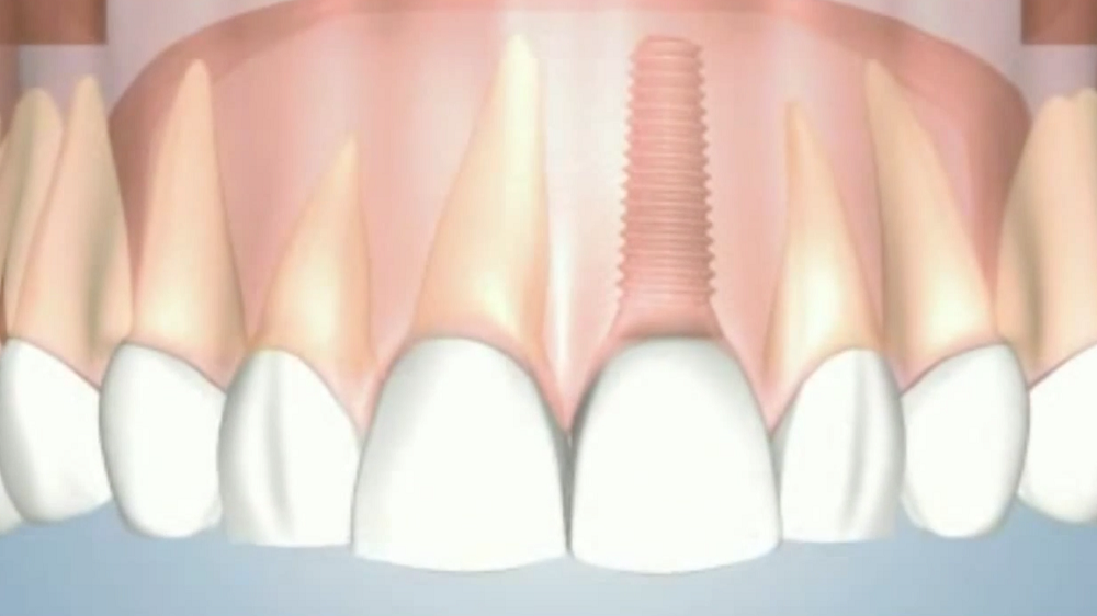 Dental Video Gallery – Ashton Avenue Dental Practice