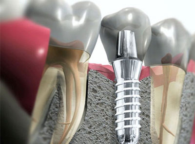 Best Dental Hospital in Amalapuram