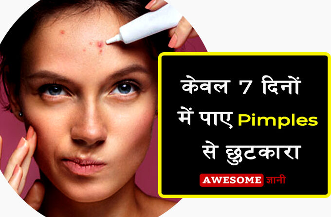 Home Remedies for Pimples in Hindi