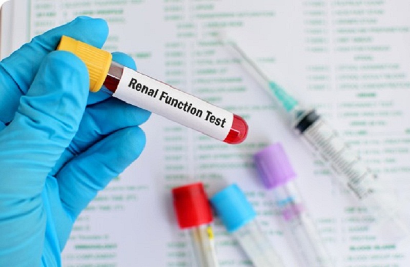 Kidney/Renal Function Test Market Size, Research, Development and Forecast to 2028 Including Covid19 Impact Analysis | Siemens Healthcare Private Limited, Danaher, Sysmex Corporation, F. Hoffmann-La Roche Ltd., Abbott, Nova Biomedical