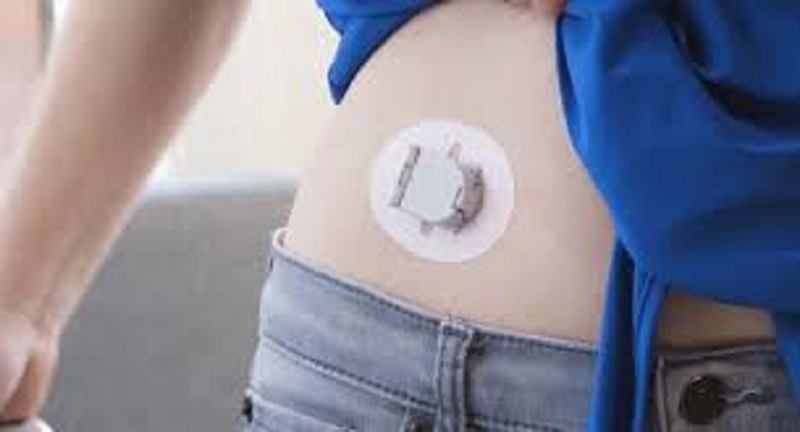 North America Biosensors Market Has Exploded: Opportunities & Challenges in Near Future with Key Players like Abbott, Johnson & Johnson Services, Inc., Siemens AG, Medtronic, Bio-Rad Laboratories, Inc., AgaMatrix