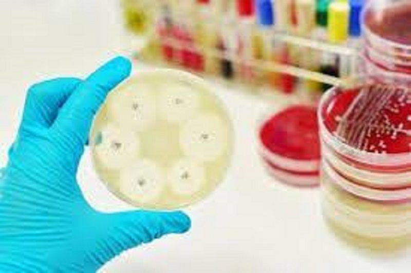 Asia-Pacific Antimicrobial Susceptibility Testing Market to See Astonishing Growth by 2019-2026 Leading Players Are Mast Group Ltd., HiMedia Laboratories, ThermoFisher Scientific Inc.,