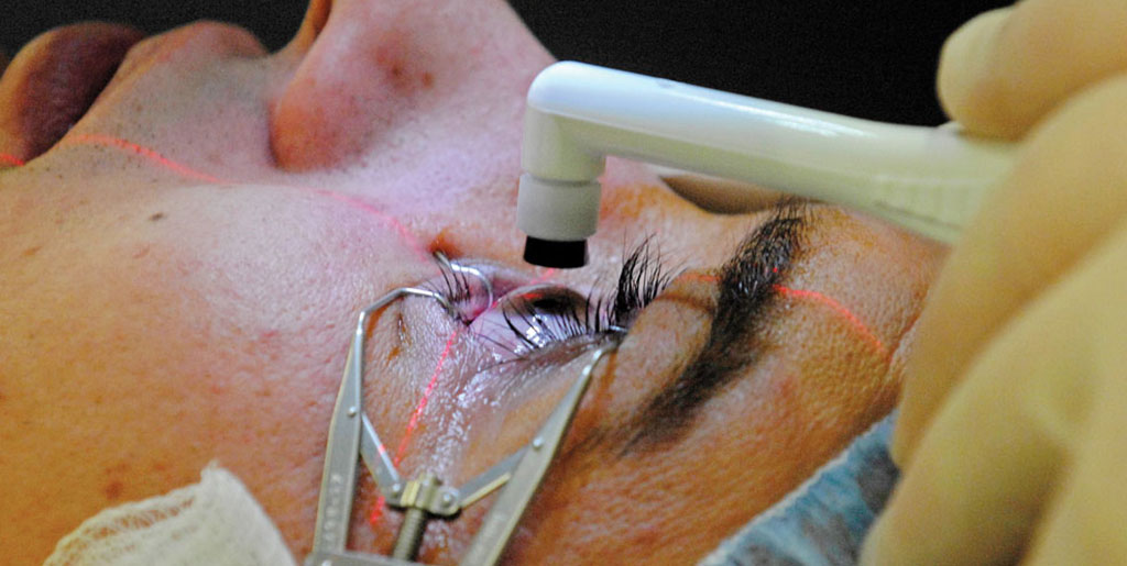 Things to know of PanOptix trifocal lens