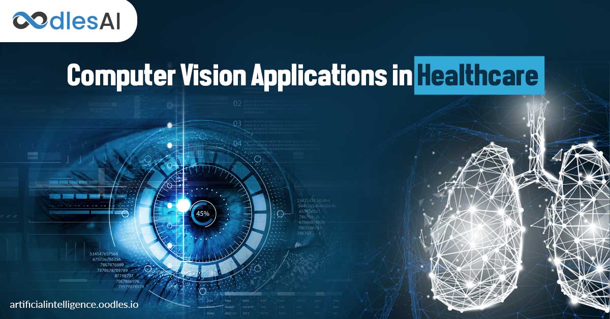 Computer Vision Applications in Healthcare