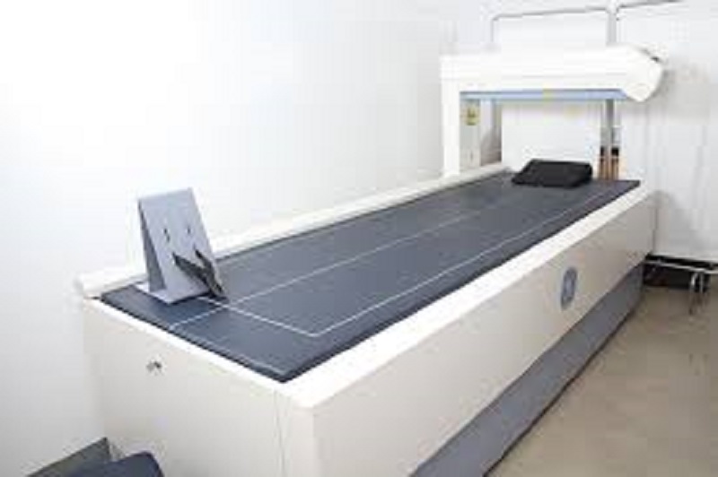 Bone Densitometer Devices Market Has Exploded: Opportunities & Challenges in Near Future with Key Players like BeamMed Ltd., CompuMed, Inc., Hologic, Inc., General Electric Company, DMS Group, Osteometer Meditech Inc.