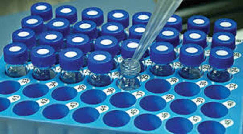 How Mass Spectrometry Software Has Exploded: Opportunities & Challenges in Near Future with Key Players like Thermo Fisher Scientific Inc.; Advanced Chemistry Development; AB Sciex Pte Ltd.; Scientific Instrument Services by Adaptas Solutions; Bruker