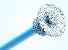 Occlusion Devices Market Dynamic Structure, Development and trends, innovations, CAPEX cycle Size Analysis Forecast 2022-2028