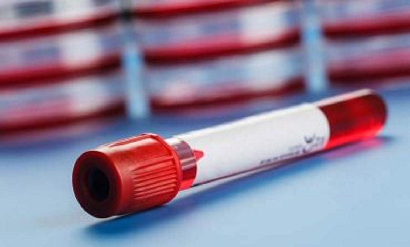 Blood Preparation Market Research Report CAGR Growth of 5.60% and Predictive Business Strategy by 2026 | Potential Players Are GlaxoSmithKline plc., Portola Pharmaceuticals, Inc., Pfizer Inc, Baxter, Bristol-Myers Squibb Company, LEO Pharma, Sanofi