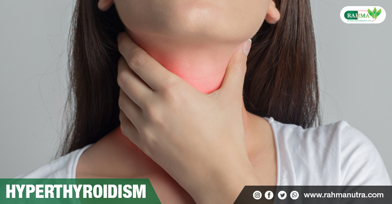 HYPERTHYROIDISM