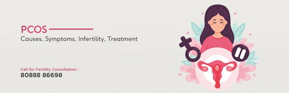 PCOS: Causes, Symptoms, Infertility, Treatment