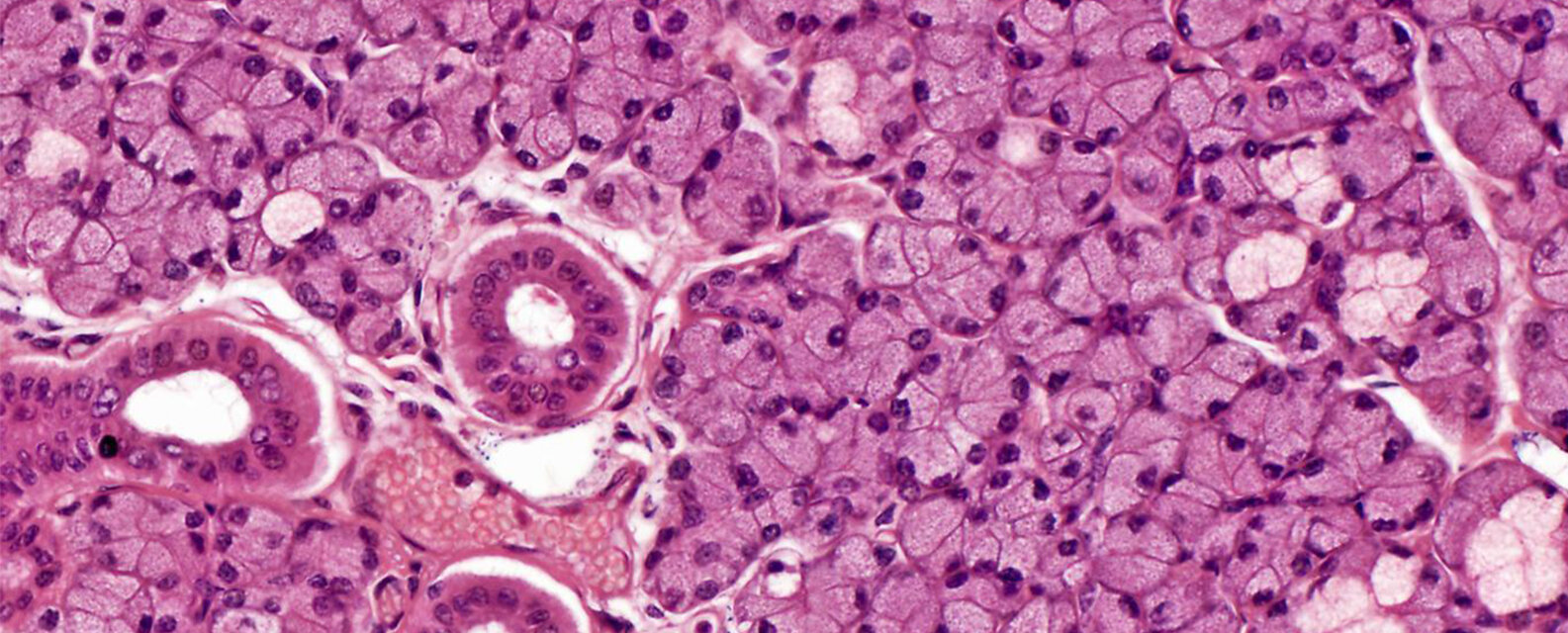 Digital Pathology Market - Technological Advancement Facilitating Market Growth : Include Covid-19 impact