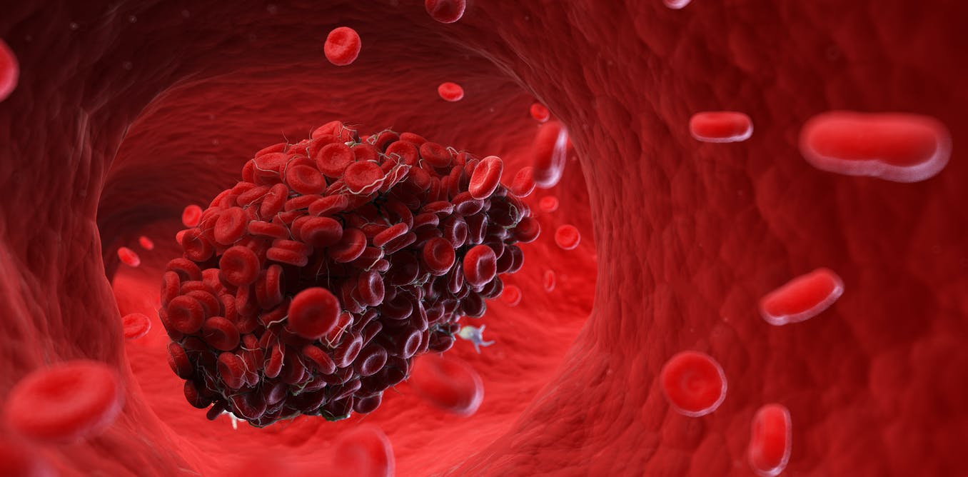 Nằm mơ thấy máu có ý nghĩa gì?