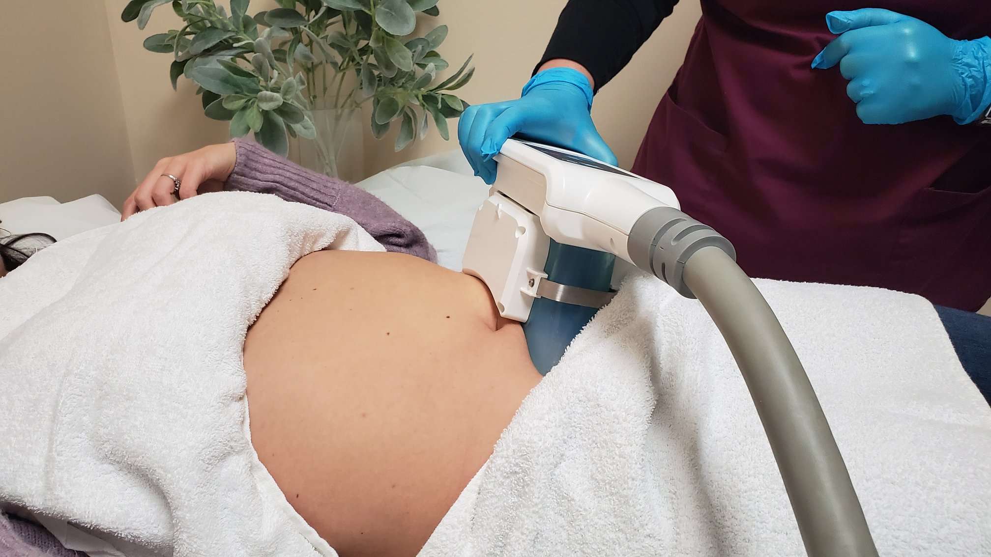 Check different techniques to find how much does coolsculpting costs?