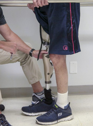 Different Types Of Orthoses Explained