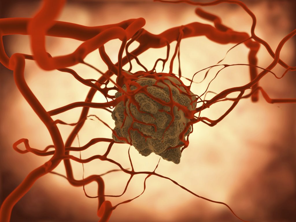 US Embolotherapy Market Latest Trend, Growth, Size, Application & Forecast 2025