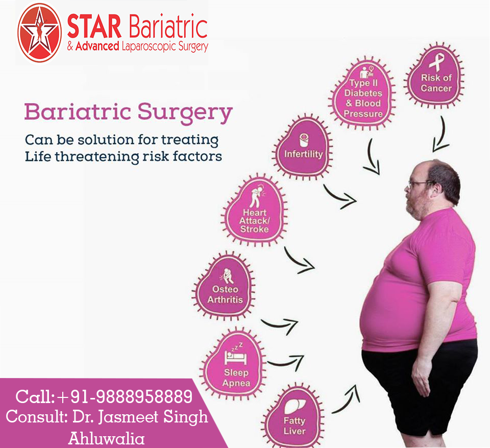 what is bariatric surgery