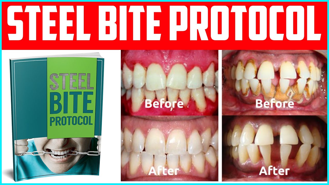 how to get rid of sensitive teeth after eating lemon get 100% solution