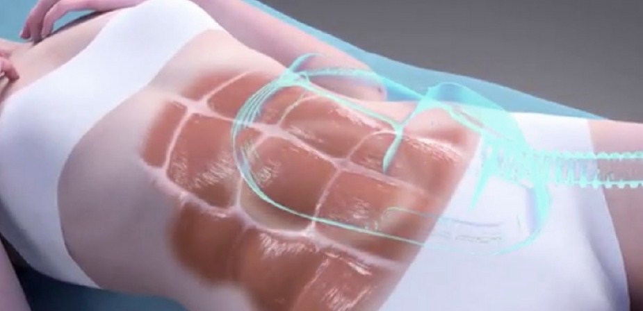 Emsculpt london