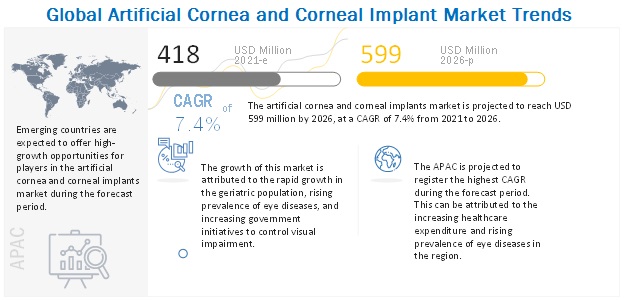 Artificial Cornea and Corneal Implant Market Trends, In-depth Analysis, Top 10 Company Profiles and Forecast to 2026