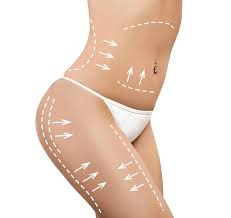 TummyTITE | Alternative to Lipo | Omniya Clinic London