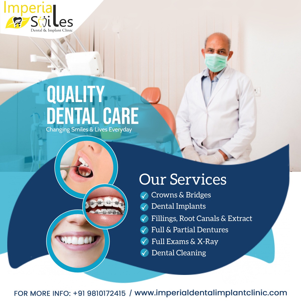Crown and Bridge Treatment in Sector 82 Gurgaon