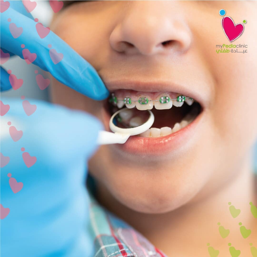 Pediatric Dentistry in Dubai