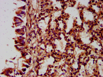 Global Biotinylated Polyclonal Antibody Market: Detailed Analysis by Latest Trends, Demand and Forecast to 2027