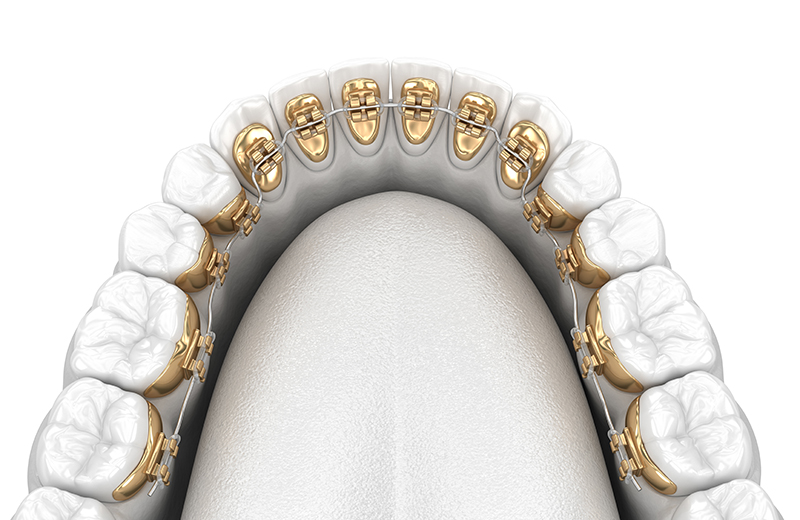 When should you plan to visit an Orthodontics in Upper East Side?