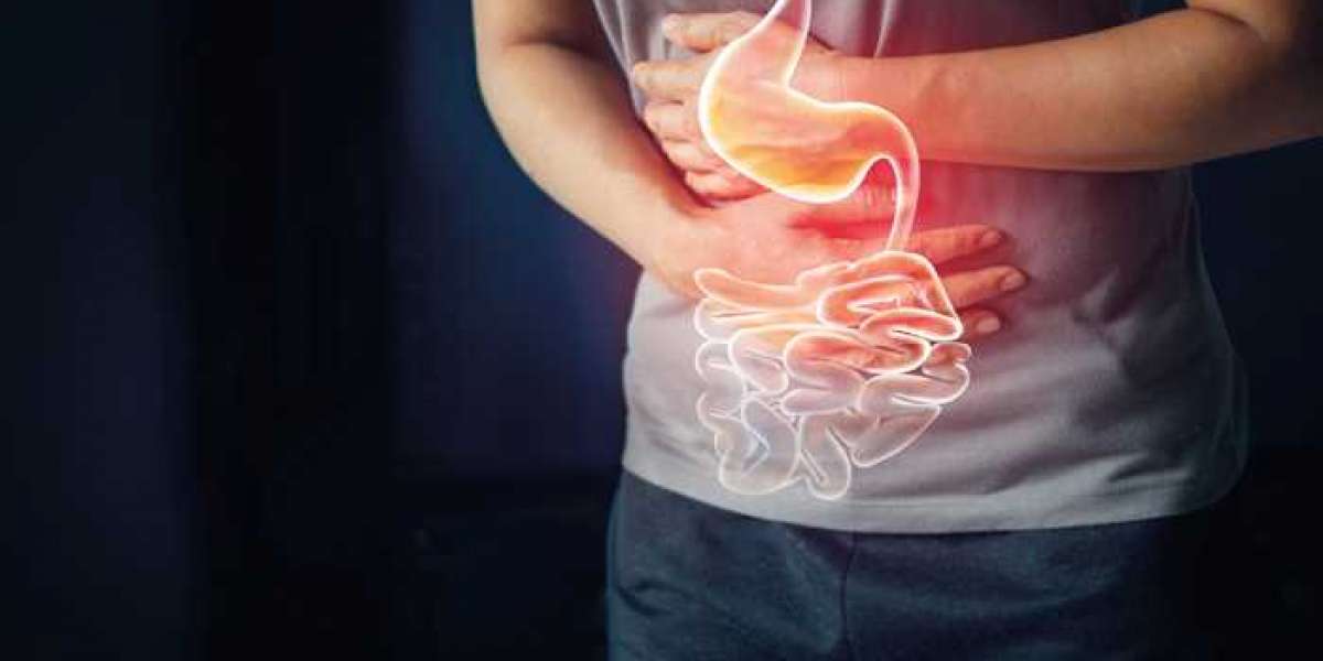 How to take a Probiolite acid reflux supplement?