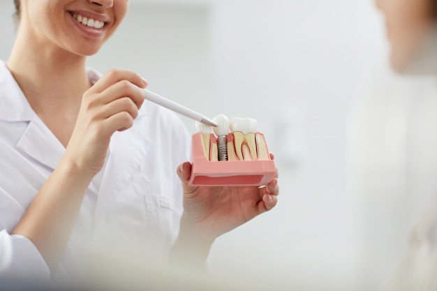 Dental Implant Services Vernon Hills