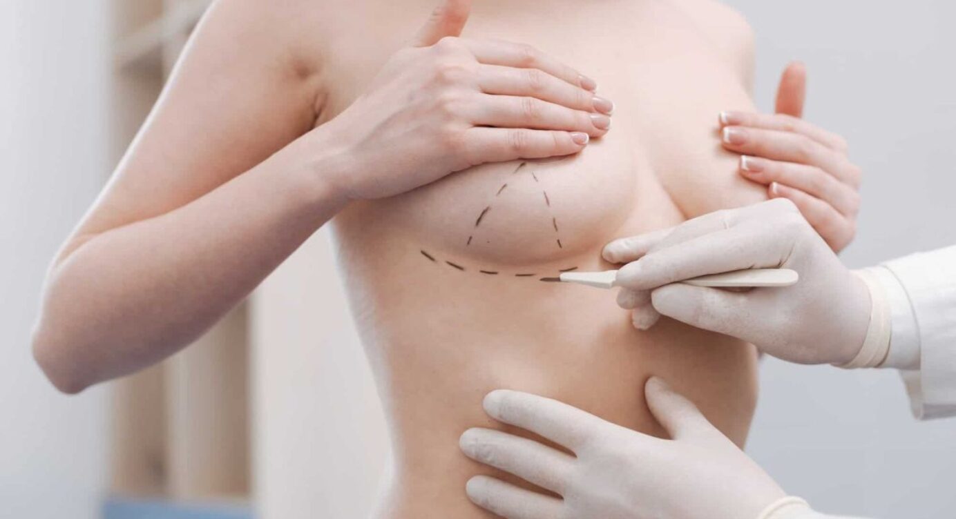 Best Breast Augmentation Surgery - Chase Plastic Surgery