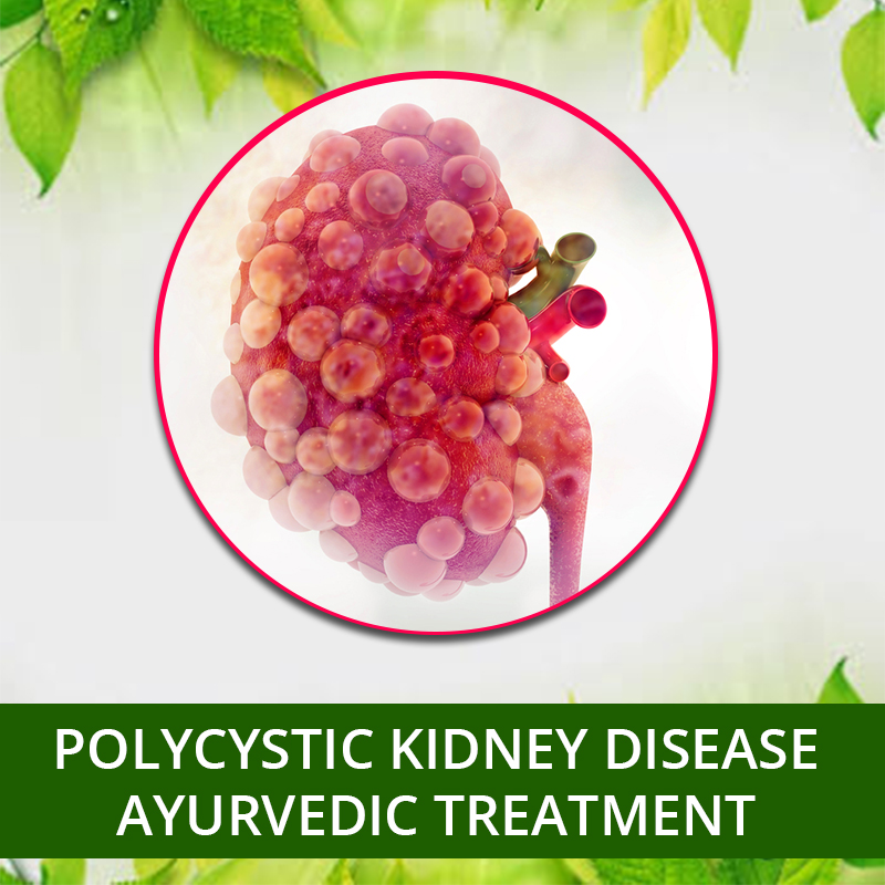 Polycystic Kidney Disease Ayurvedic Treatment