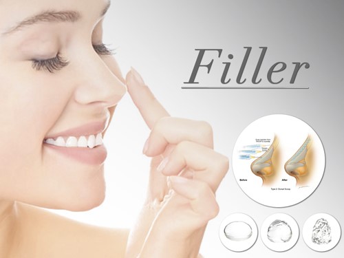 Giải đáp: có nên nâng mũi bằng filler không?